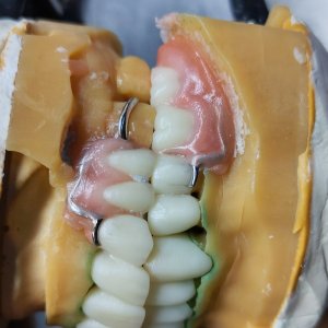 Smile Protez Calisma 3