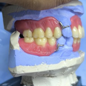 Smile Protez Calisma 1