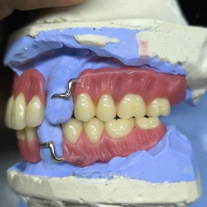 Smile Protez Calisma 6