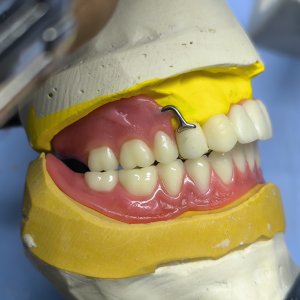 Smile Protez Calisma 7