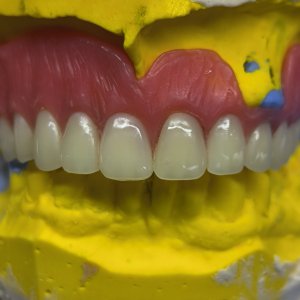 Smile Protez Calisma 8