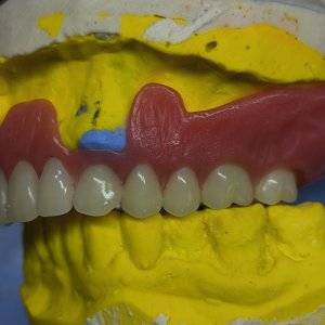 Smile Protez Calisma 9