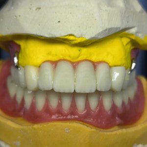 Smile Protez Calisma 10