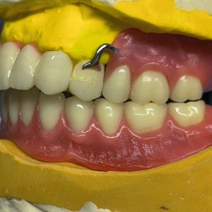 Smile Protez Calisma 11