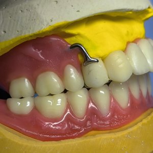 Smile Protez Calisma 12