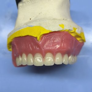 Smile Protez Calisma 13