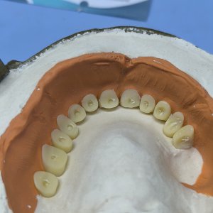 Smile Protez Calisma 14