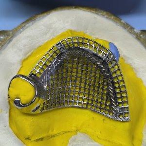 Smile Protez Calisma 15