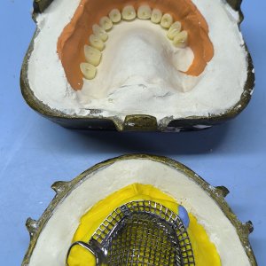 Smile Protez Calisma 16