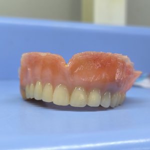 Smile Protez Calisma 17