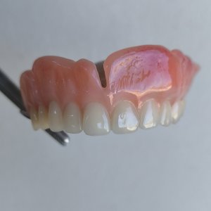 Smile Protez Calisma 2