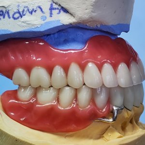 Smile Protez Calisma 3