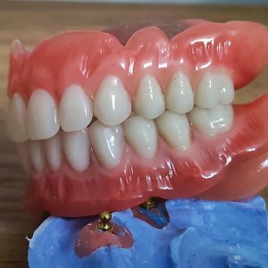 Smile Protez Calisma 4