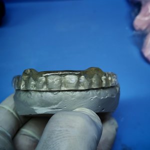 Smile Protez Calisma 8