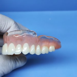 Smile Protez Calisma 10